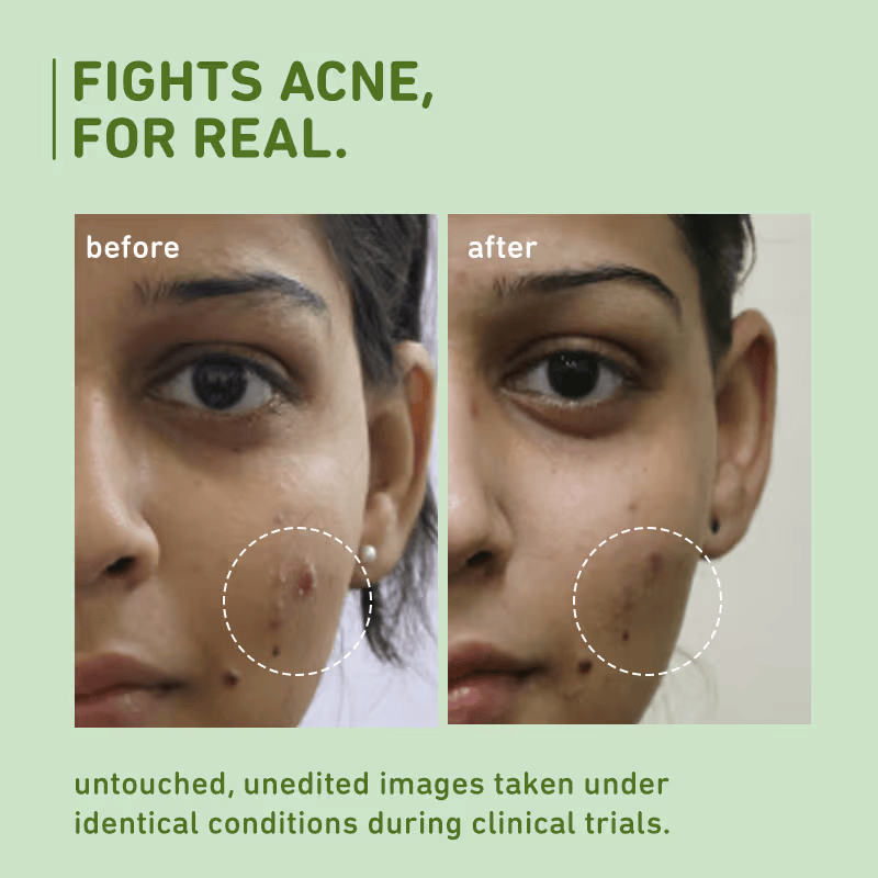 Green Tea Pore Cleansing Gel Face Wash Cosmetic Cove